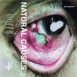 Natural Causes // Buttercup TAPE