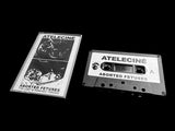 ATELECINÉ // Aborted Fetuses TAPE
