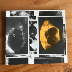 Maurizio Bianchi (M.B.) // Qoheleth Strepitus CDR