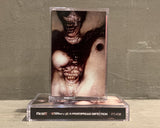 Exome // Humanity Is A Widespread Infection TAPE
